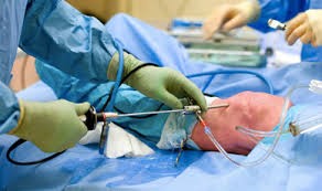 arthroscopy